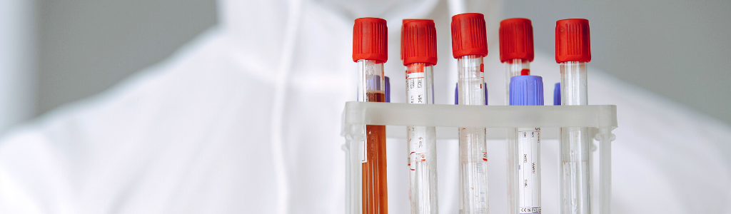 Anti-SARS-CoV-2 (COVID-19) IgG, нейтрализующие антитела к рецептор-связывающему домену (RBD) белка S1 (кач.) Anti-SARS-CoV-2 (COVID-19) IgG, нейтрализующие антитела к рецептор-связывающему домену (RBD) белка S1 (кач.)